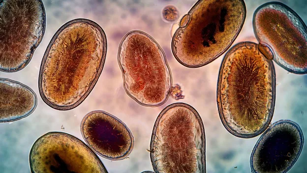 Protozoa seen under a microscope